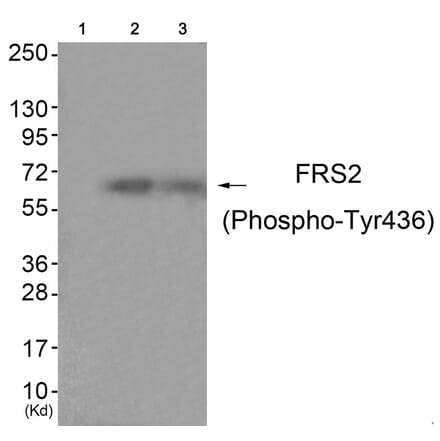 Western blot - FRS2 (Phospho-Tyr436) Antibody from Signalway Antibody (11769) - Antibodies.com
