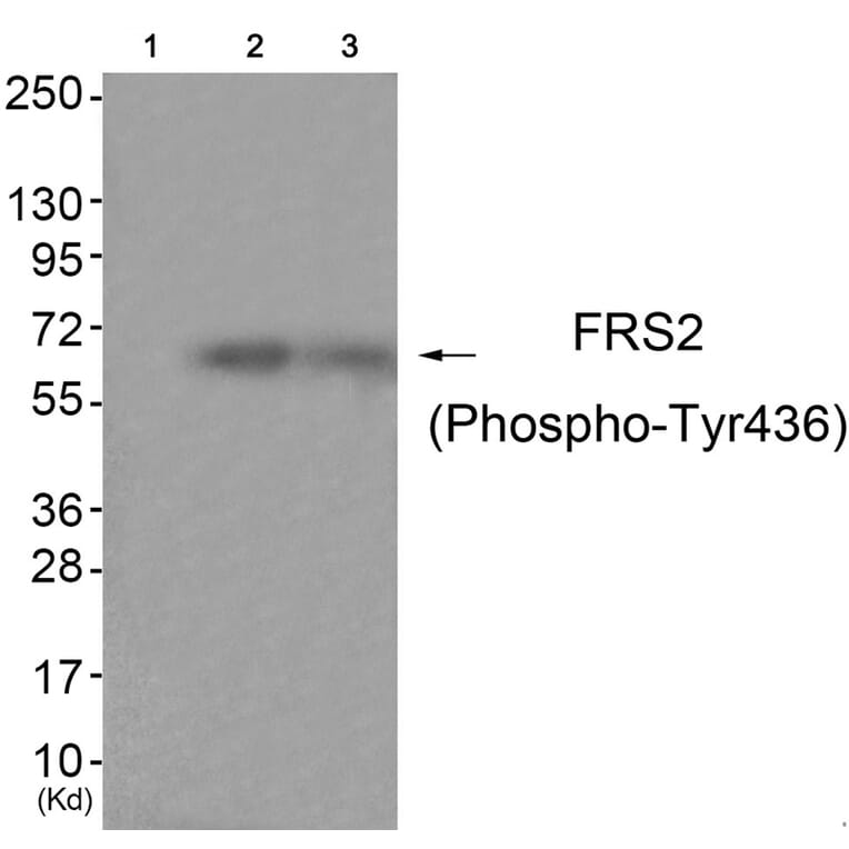 Western blot - FRS2 (Phospho-Tyr436) Antibody from Signalway Antibody (11769) - Antibodies.com