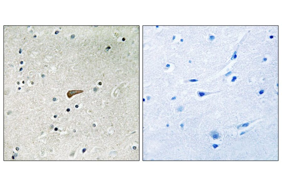 Immunohistochemistry - FRS2 (Phospho-Tyr436) Antibody from Signalway Antibody (11769) - Antibodies.com