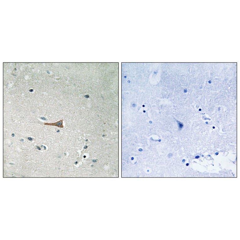 Immunohistochemistry - DDR1 (Phospho-Tyr513) Antibody from Signalway Antibody (11770) - Antibodies.com