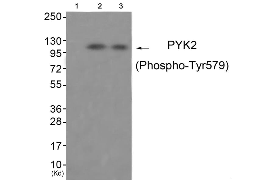 Western blot - PYK2 (Phospho-Tyr579) Antibody from Signalway Antibody (11776) - Antibodies.com