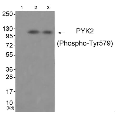 Western blot - PYK2 (Phospho-Tyr579) Antibody from Signalway Antibody (11776) - Antibodies.com
