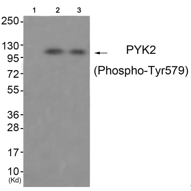 Western blot - PYK2 (Phospho-Tyr579) Antibody from Signalway Antibody (11776) - Antibodies.com