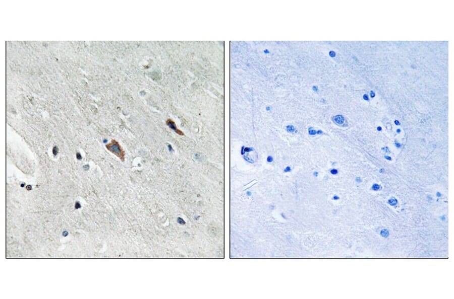 Immunohistochemistry - Gab2 (Phospho-Tyr643) Antibody from Signalway Antibody (11802) - Antibodies.com