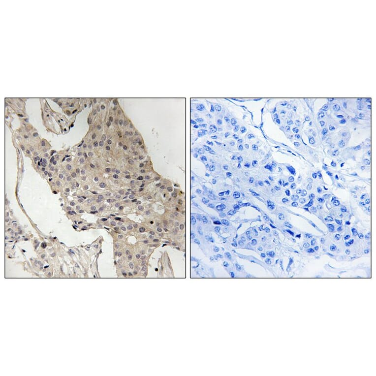 Immunohistochemistry - Gab2 (Phospho-Ser623) Antibody from Signalway Antibody (11803) - Antibodies.com