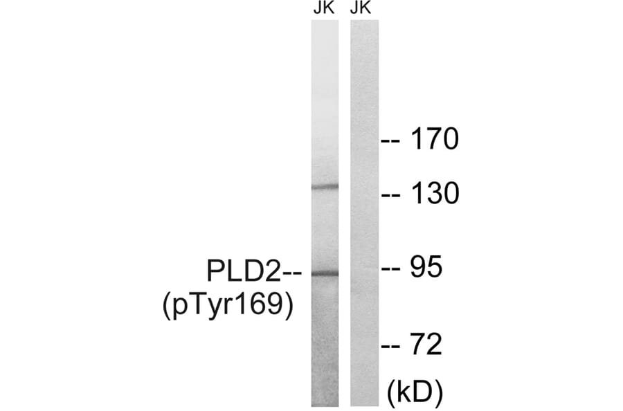 Western blot - PLD2 (Phospho-Tyr169) Antibody from Signalway Antibody (11813) - Antibodies.com