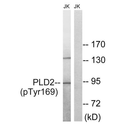 Western blot - PLD2 (Phospho-Tyr169) Antibody from Signalway Antibody (11813) - Antibodies.com