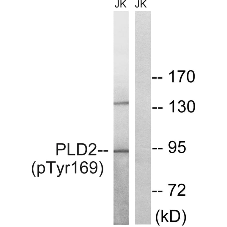 Western blot - PLD2 (Phospho-Tyr169) Antibody from Signalway Antibody (11813) - Antibodies.com