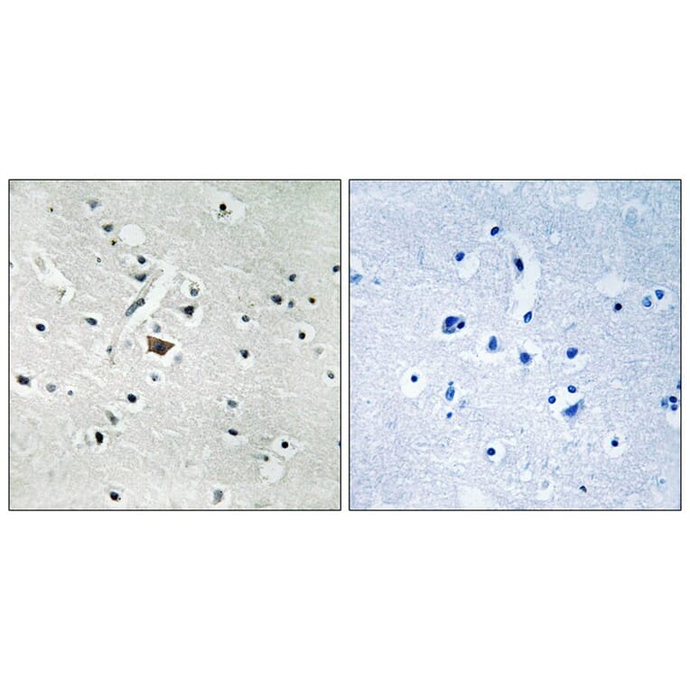 Immunohistochemistry - PLD2 (Phospho-Tyr169) Antibody from Signalway Antibody (11813) - Antibodies.com