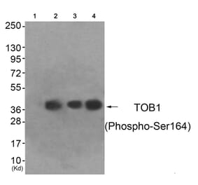 Western blot - TOB1 (Phospho-Ser164) Antibody from Signalway Antibody (11816) - Antibodies.com