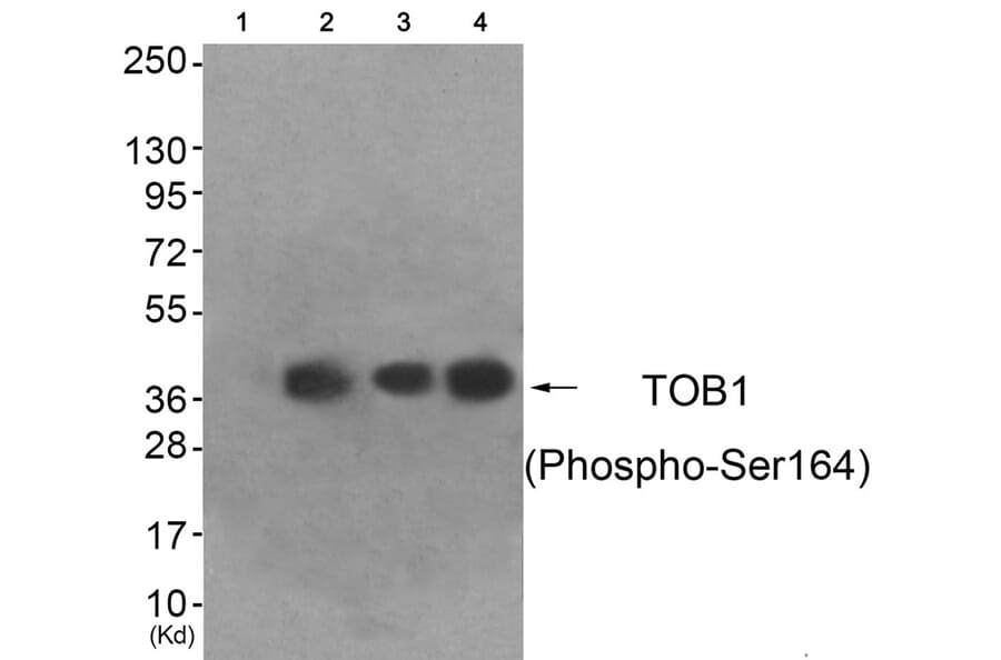Western blot - TOB1 (Phospho-Ser164) Antibody from Signalway Antibody (11816) - Antibodies.com