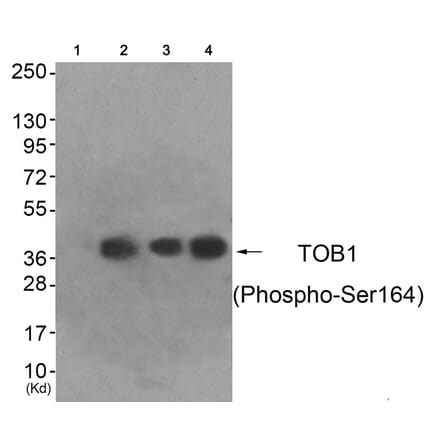Western blot - TOB1 (Phospho-Ser164) Antibody from Signalway Antibody (11816) - Antibodies.com