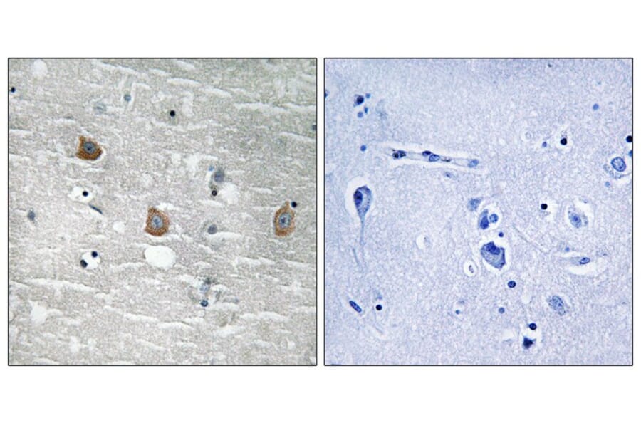 Immunohistochemistry - TOB1 (Phospho-Ser164) Antibody from Signalway Antibody (11816) - Antibodies.com