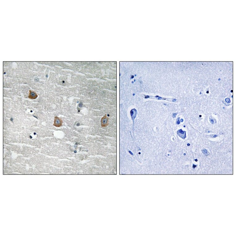 Immunohistochemistry - TOB1 (Phospho-Ser164) Antibody from Signalway Antibody (11816) - Antibodies.com