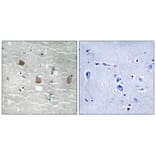 Immunohistochemistry - TOB1 (Phospho-Ser164) Antibody from Signalway Antibody (11816) - Antibodies.com
