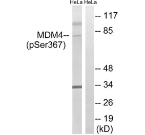 Western blot - MDM4 (Phospho-Ser367) Antibody from Signalway Antibody (12141) - Antibodies.com