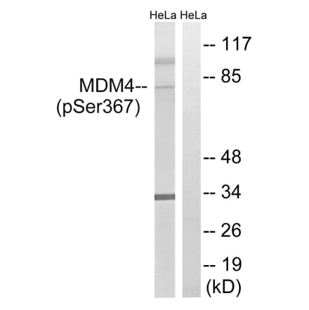 Western blot - MDM4 (Phospho-Ser367) Antibody from Signalway Antibody (12141) - Antibodies.com