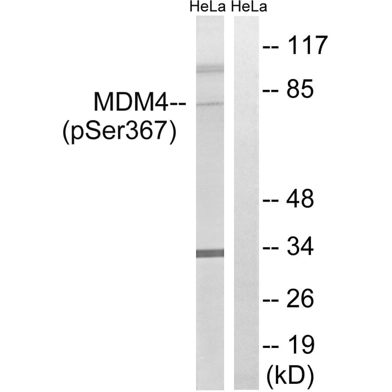 Western blot - MDM4 (Phospho-Ser367) Antibody from Signalway Antibody (12141) - Antibodies.com