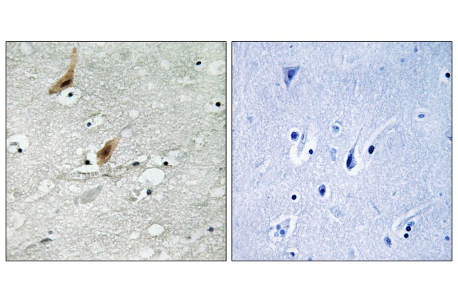 Immunohistochemistry - MSK2 (Phospho-Thr568) Antibody from Signalway Antibody (12143) - Antibodies.com