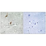 Immunohistochemistry - MSK2 (Phospho-Thr568) Antibody from Signalway Antibody (12143) - Antibodies.com