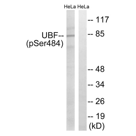 Western blot - UBF (Phospho-Ser484) Antibody from Signalway Antibody (12154) - Antibodies.com