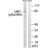 Western blot - UBF (Phospho-Ser484) Antibody from Signalway Antibody (12154) - Antibodies.com