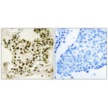 Immunohistochemistry - UBF (Phospho-Ser484) Antibody from Signalway Antibody (12154) - Antibodies.com