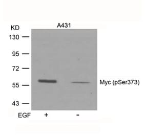 Western blot - Myc (Phospho-Ser373) Antibody from Signalway Antibody (11036) - Antibodies.com