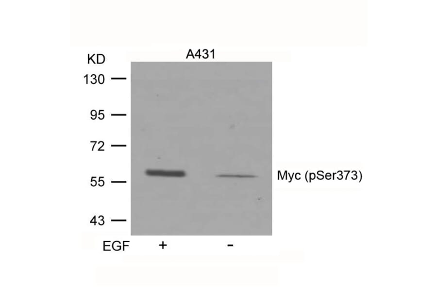 Western blot - Myc (Phospho-Ser373) Antibody from Signalway Antibody (11036) - Antibodies.com