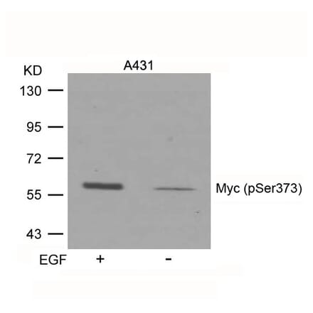 Western blot - Myc (Phospho-Ser373) Antibody from Signalway Antibody (11036) - Antibodies.com