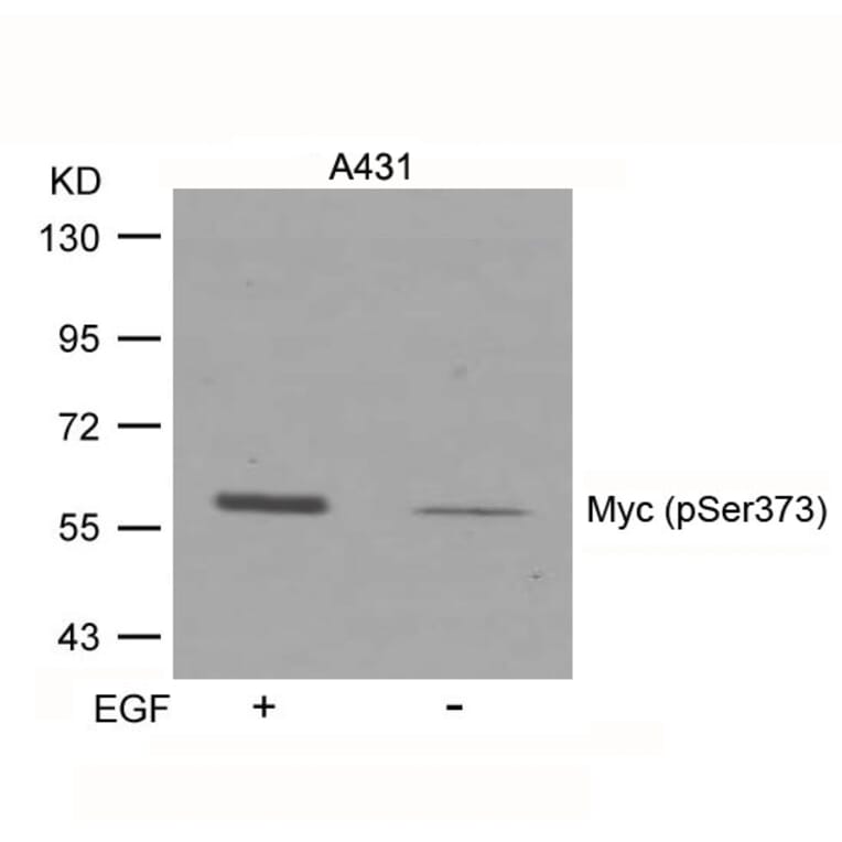 Western blot - Myc (Phospho-Ser373) Antibody from Signalway Antibody (11036) - Antibodies.com