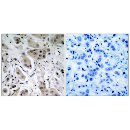 Immunohistochemistry - Akt (Phospho-Ser473) Antibody from Signalway Antibody (11054) - Antibodies.com