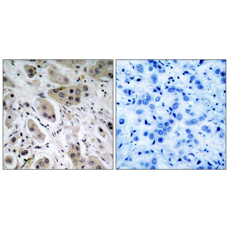 Immunohistochemistry - Akt (Phospho-Ser473) Antibody from Signalway Antibody (11054) - Antibodies.com