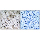 Immunohistochemistry - Akt (Phospho-Ser473) Antibody from Signalway Antibody (11054) - Antibodies.com