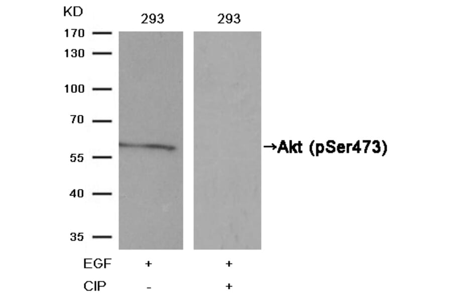 Western blot - Akt (Phospho-Ser473) Antibody from Signalway Antibody (11054) - Antibodies.com