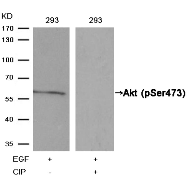 Western blot - Akt (Phospho-Ser473) Antibody from Signalway Antibody (11054) - Antibodies.com