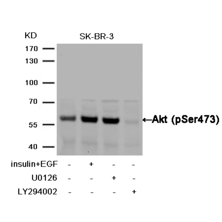 Western blot - Akt (Phospho-Ser473) Antibody from Signalway Antibody (11054) - Antibodies.com