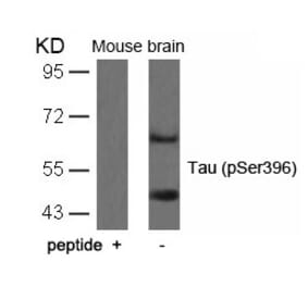 Western blot - Tau (Phospho-Ser396) Antibody from Signalway Antibody (11102) - Antibodies.com