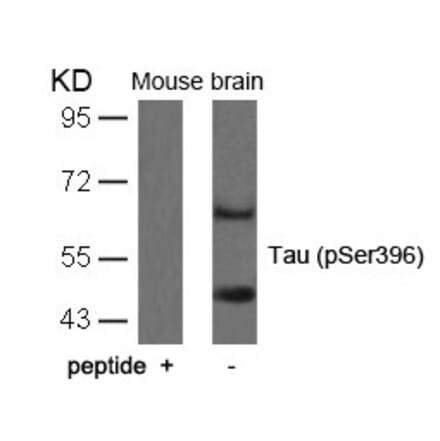 Western blot - Tau (Phospho-Ser396) Antibody from Signalway Antibody (11102) - Antibodies.com