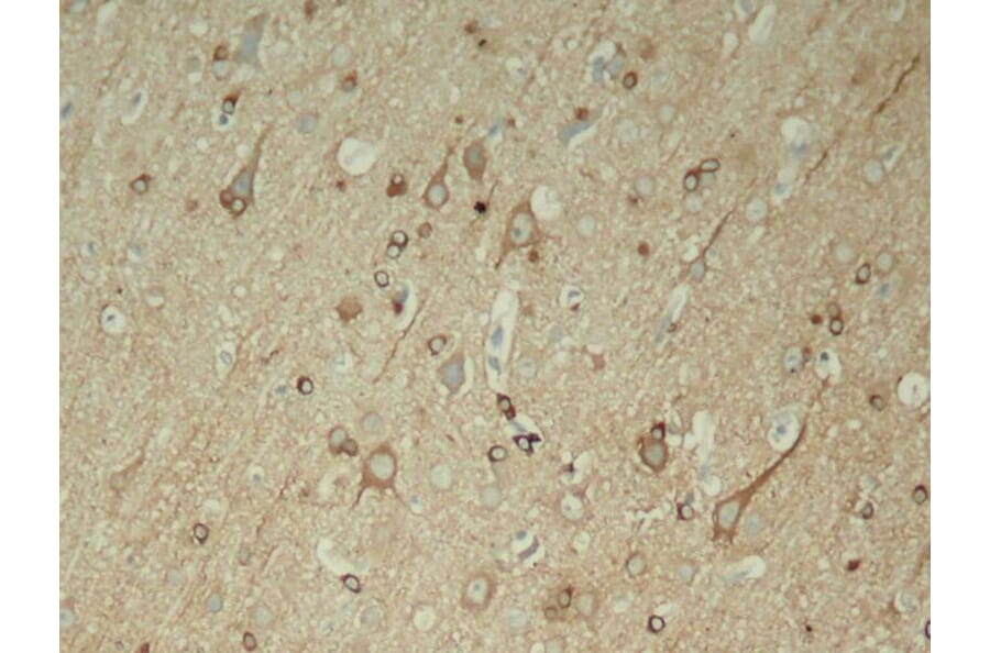 Immunohistochemistry - Tau (Phospho-Ser396) Antibody from Signalway Antibody (11102) - Antibodies.com