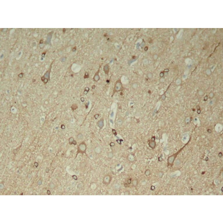 Immunohistochemistry - Tau (Phospho-Ser396) Antibody from Signalway Antibody (11102) - Antibodies.com