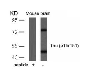Western blot - Tau (Phospho-Thr181) Antibody from Signalway Antibody (11107) - Antibodies.com