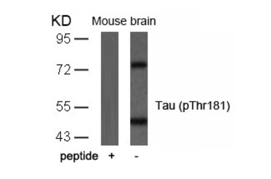 Western blot - Tau (Phospho-Thr181) Antibody from Signalway Antibody (11107) - Antibodies.com