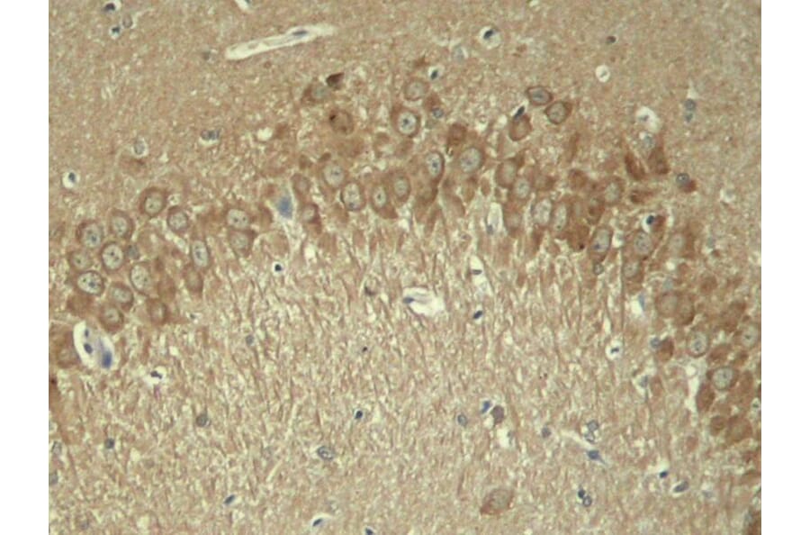Immunohistochemistry - Tau (Phospho-Thr181) Antibody from Signalway Antibody (11107) - Antibodies.com
