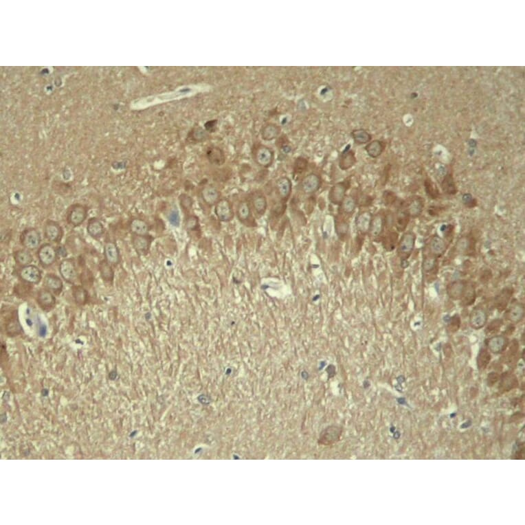 Immunohistochemistry - Tau (Phospho-Thr181) Antibody from Signalway Antibody (11107) - Antibodies.com