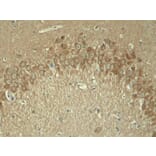 Immunohistochemistry - Tau (Phospho-Thr181) Antibody from Signalway Antibody (11107) - Antibodies.com