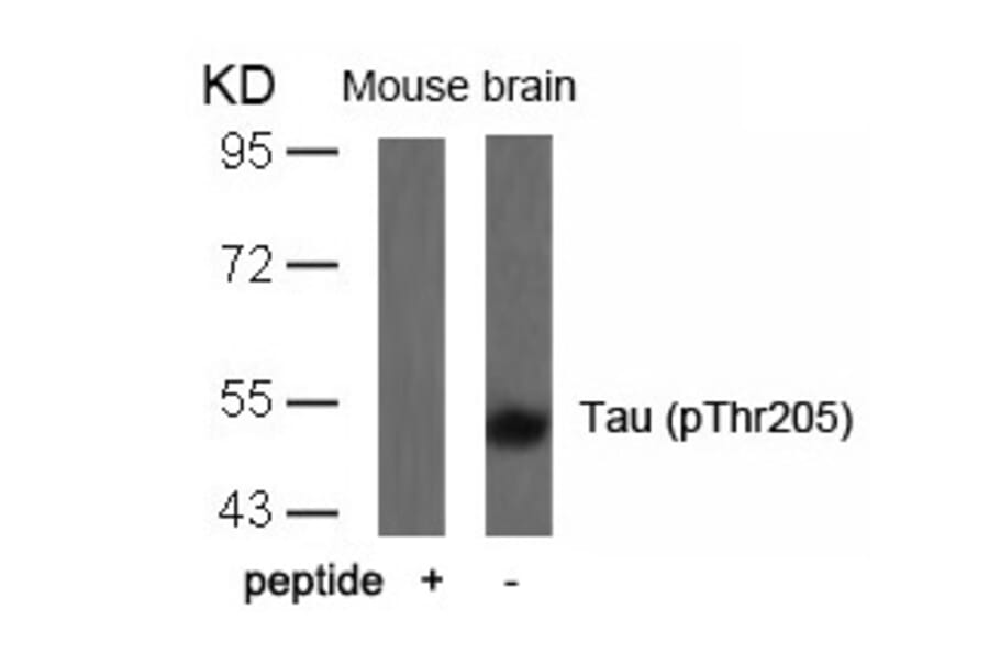 Western blot - Tau (Phospho-Thr205) Antibody from Signalway Antibody (11108) - Antibodies.com