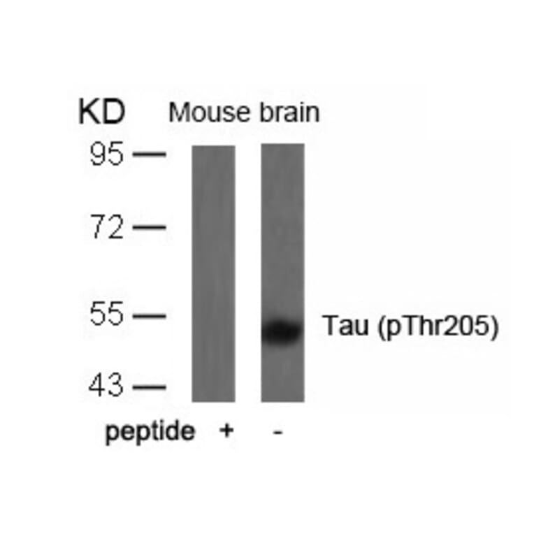 Western blot - Tau (Phospho-Thr205) Antibody from Signalway Antibody (11108) - Antibodies.com
