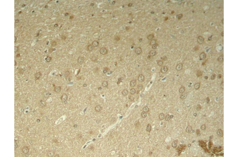 Immunohistochemistry - Tau (Phospho-Thr205) Antibody from Signalway Antibody (11108) - Antibodies.com