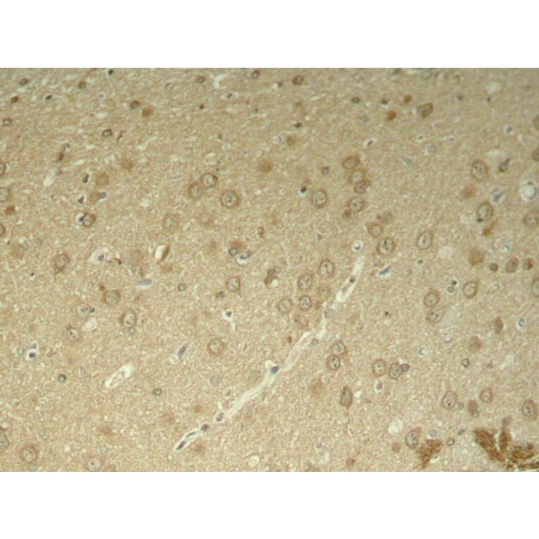Immunohistochemistry - Tau (Phospho-Thr205) Antibody from Signalway Antibody (11108) - Antibodies.com